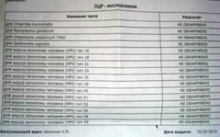 Анализ на ВПЧ при замершей беременности