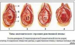 Беременность при лишении девственности без ПА